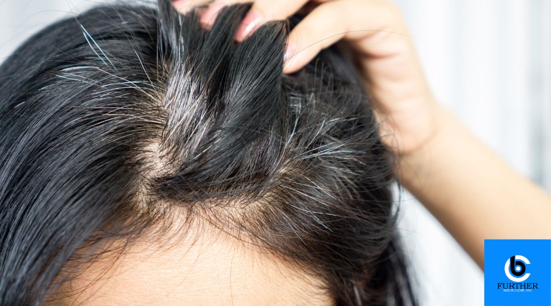 wellhealthorganic.com/know-the-causes-of-white-hair-and-easy-ways-to-prevent-it-naturally